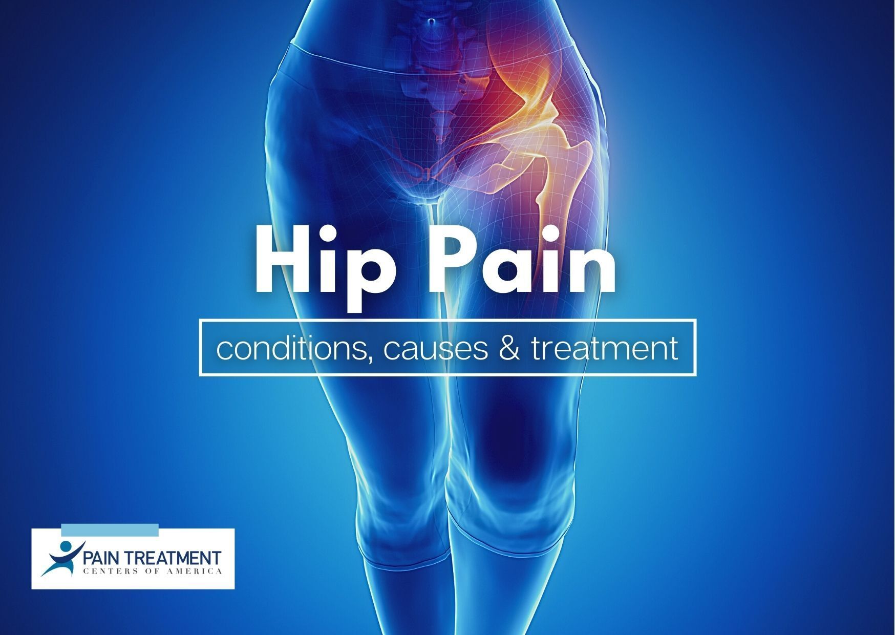 What can be mistaken for hip pain?